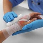 Top Burn Accident Attorney in Washington, DC – Get the Compensation You Deserve