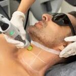 What to Expect from Laser Hair Removal Clinics in Dubai: A Patient’s Perspective